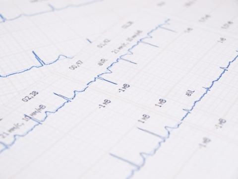 Atrial Fibrillation